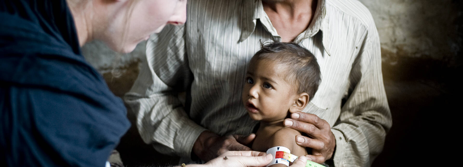 Kleines Kind bei der Messung seines Armumfangs mithilfe des MUAC-Bands. Diagnose: schwere Mangelernährung