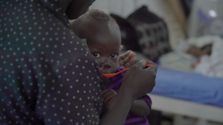 akut-mangelernaehrtes-kind-in-uganda-tv-spot-werbung-aktion-gegen-den-hunger-jetzt-spenden_0 akut-mangelernaehrtes-kind-in-uganda-tv-spot-werbung-aktion-gegen-den-hunger-jetzt-spenden_0