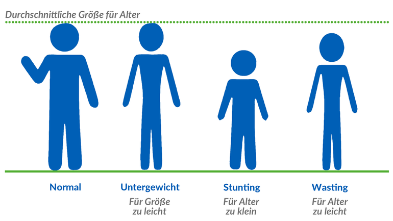 Grafik Unterernährung Grafik Unterernährung