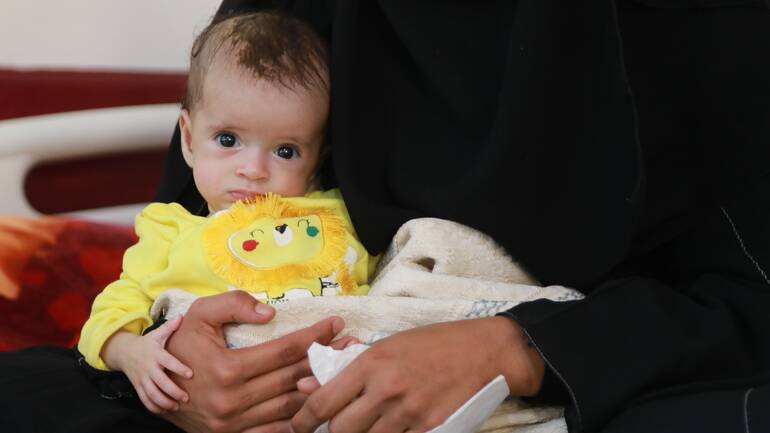Haylah aus dem Jemen wurde im Krieg geboren und ist mangelernährt. Die kleine Haylah aus dem Jemen in den Armen ihrer Mutter