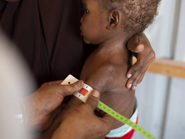 Bei Halima wird akute Mangelernährung mit dem MUAC-Band diagnostiziert Bei Halima wird akute Mangelernährung mit dem MUAC-Band diagnostiziert