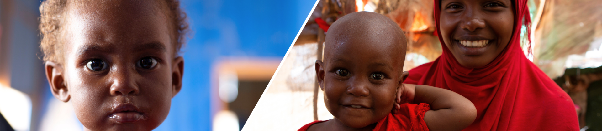 Halima während und nach ihrer Behandlung gegen Mangelernährung. Ihre Mutter ist glücklich. Collage: links ist Halima zu sehen, sie schaut mit kritischem Blick in die Kamera; rechts sitzt Halima auf dem Schoß ihrer Mutter, beide lächeln glücklich.