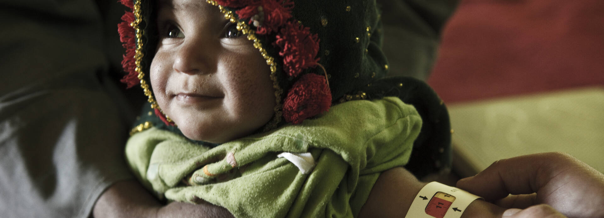 Ein mit Kapuze und dicker Kleidung eingepacktes Kleinkind, das MUAC-Band am Arm zeigt Mangelernährung