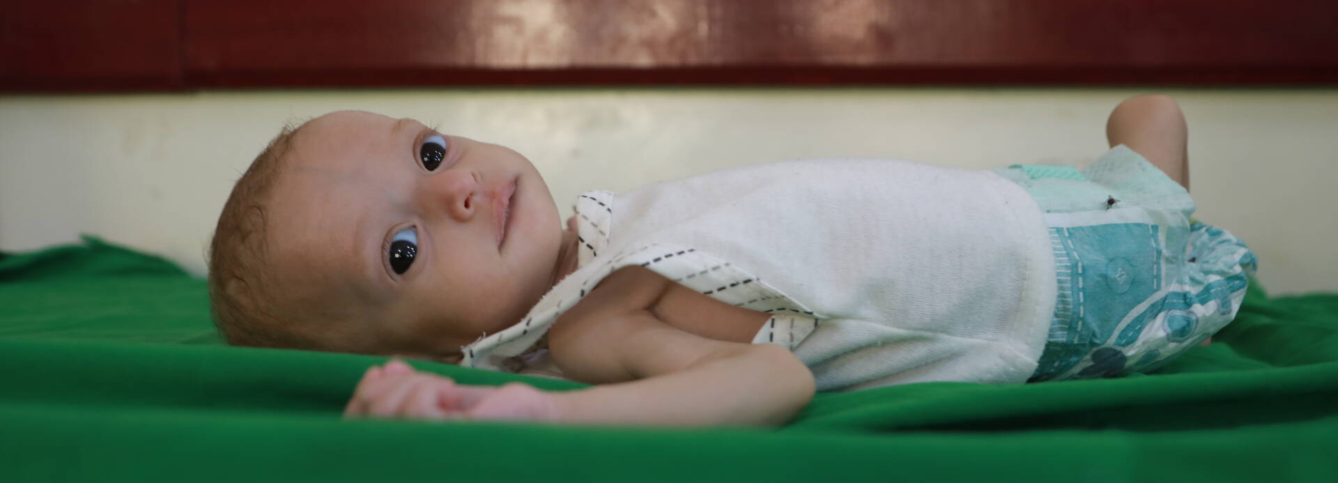 Die kleine Nasmah aus dem Jemen kommt wieder zu Kräften