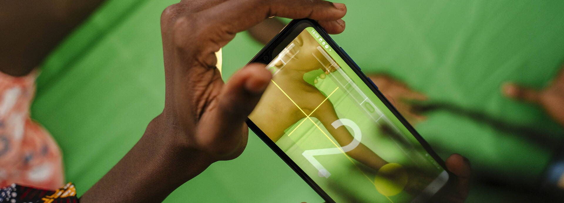 Mit unserer SAM Foto-App® können Kinder anhand von Fotos, die mit einer Smartphone-Kamera aufgenommen wurden, auf Mangelernährung untersucht werden. Mit unserer SAM Foto-App® können Kinder anhand von Fotos, die mit einer Smartphone-Kamera aufgenommen wurden, auf Mangelernährung untersucht werden.