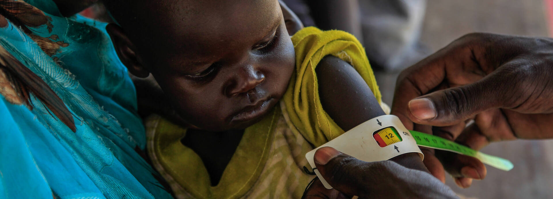 Helfer untersuchen im Südsudan ein Kind.