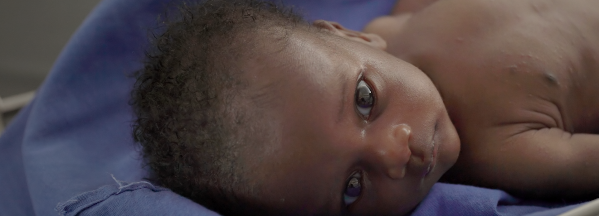 Patrick ist akut mangelernährt. Er wird in einem Gesundheitszentrum von Aktion gegen den Hunger in Uganda behandelt. Patrick aus unserer TV-Werbung ist akut mangelernährt. Er wird in einem Gesundheitszentrum von Aktion gegen den Hunger in Uganda behandelt.