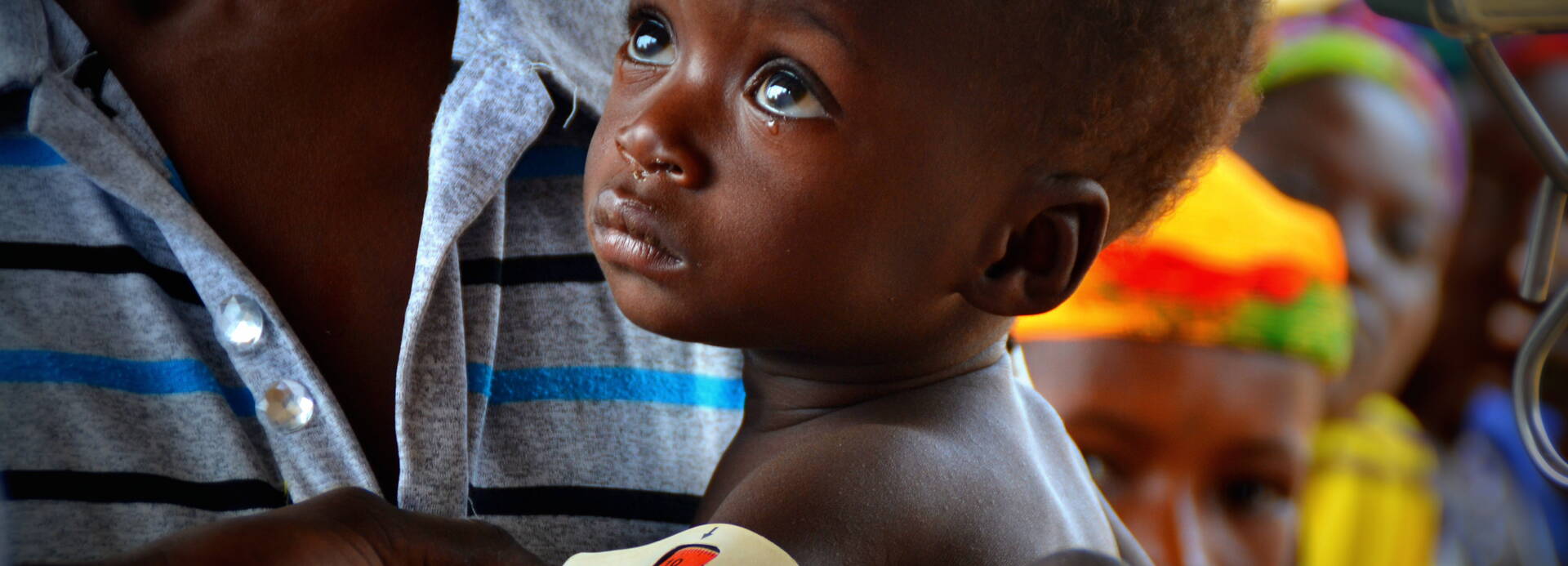 Säugling mit MUAC-Band Diagnose akute Mangelernährung