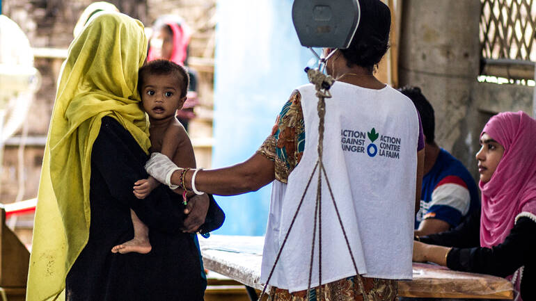 Behandlung gegen akute Mangelernährung in Bangladesch