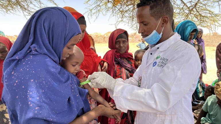 Gesundheitsuntersuchung im ländlichen Somalia: Ein Arzt im weißen Kittel untersucht ein Baby mit dem MUAC-Band auf Mangelernährung.