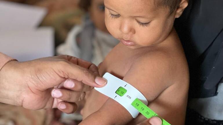Einem Jungen wird der Arm mit einem MUAC-Band gemessen, das endlich im grünen Bereich liegt.
