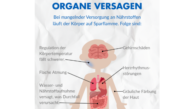Organe versagen