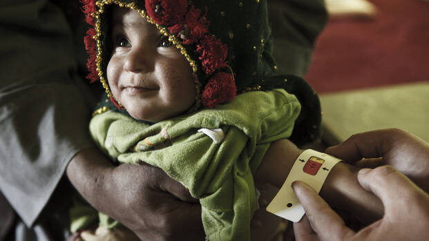 Ein mit Kapuze und dicker Kleidung eingepacktes Kleinkind, das MUAC-Band am Arm zeigt Mangelernährung